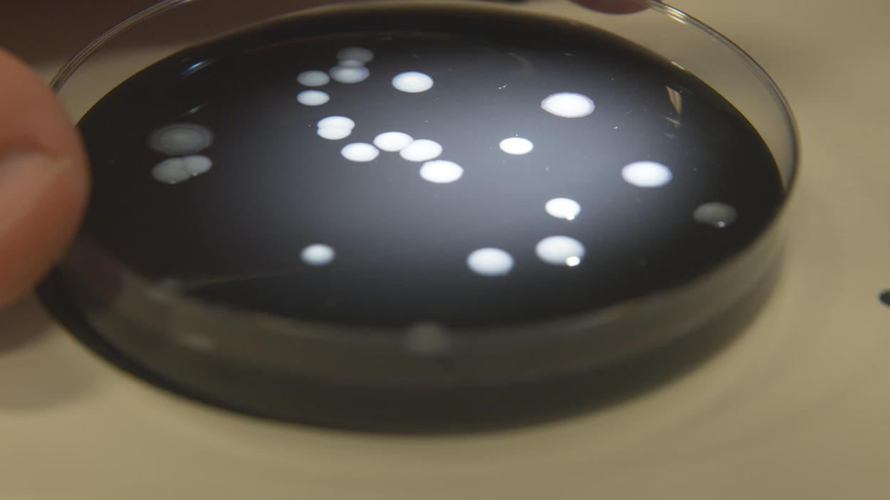 Legionella 4