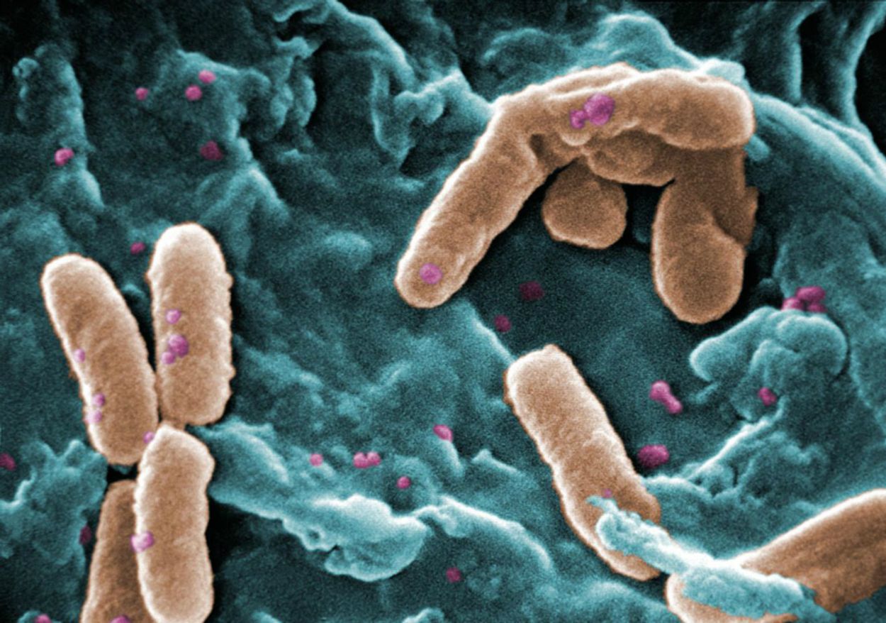 Afbeelding van Strijd tegen superbacterie vlot niet: 'Serieuze bedreiging volksgezondheid'
