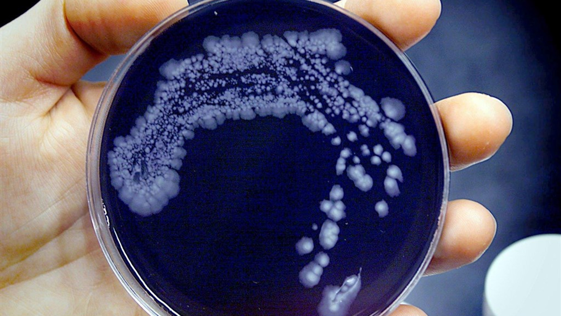 Legionella onderzoek