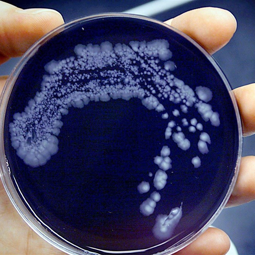 Legionella-uitbraak in België eist eerste dode