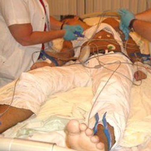 Aantal jonge comazuipers wederom toegenomen